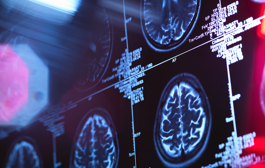 Neuroscience Overview | Academic Majors & Programs | Texas Christian