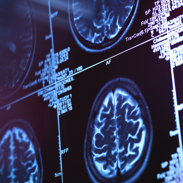 Brain MRI for Neuroscience